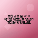 손톱 검은 세로줄 원인, 흑색종 가능성 분석